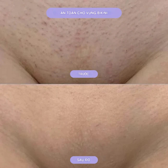 Bleame Crystal - Dụng cụ tẩy tóc